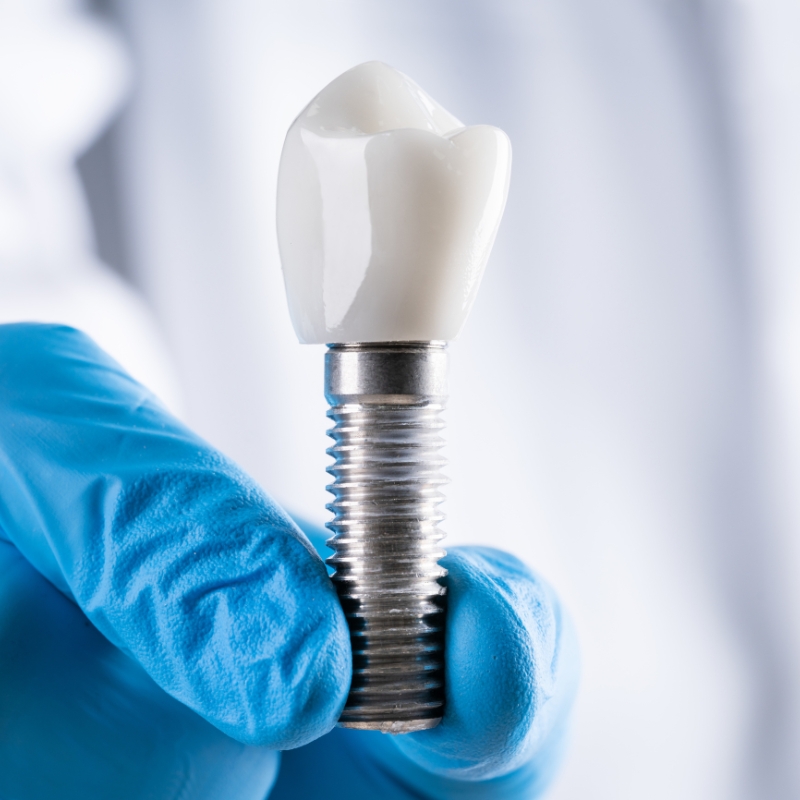 Affordable Dental Implants in Leytonstone | Restore Your Smile