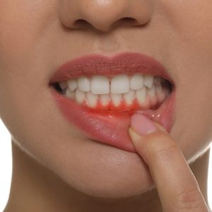 gum disease treatment leytonstone