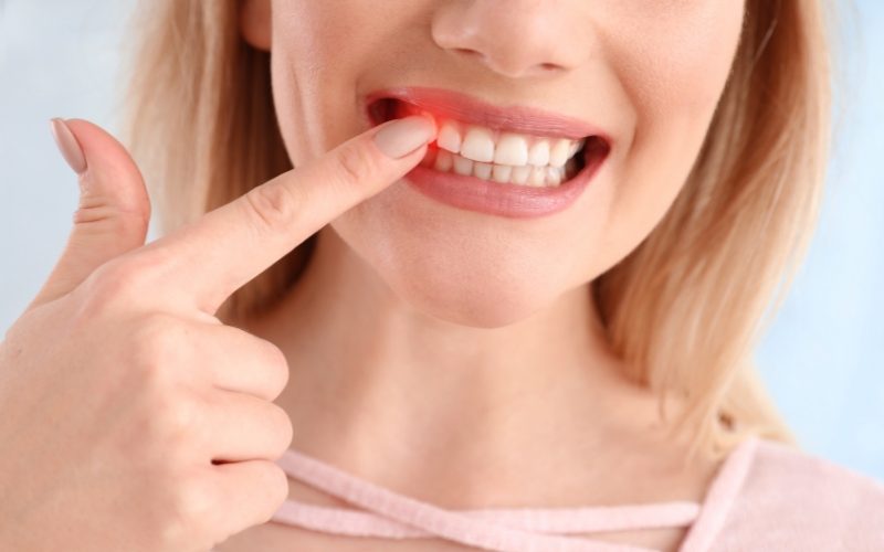 gum disease treatment leytonstone